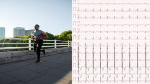 Joven Deportista Corriendo Al Aire Libre Junto A Un Electrocardiograma, Representando La Prevención Genética Del Riesgo Cardíaco En Personas Activas